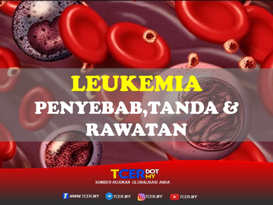 Leukemia Penyebab,TandaTanda Dan Rawatan TCER.MY