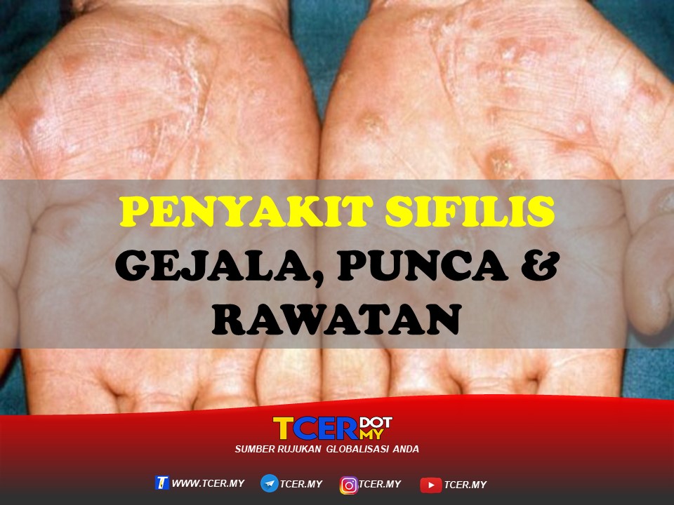 Penyakit Sifilis - Gejala, Punca Dan Juga Rawatan - TCER.MY