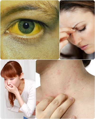 hepatitis b