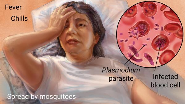 malaria