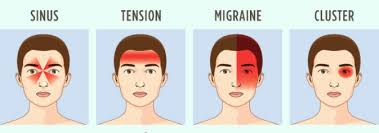 migrain