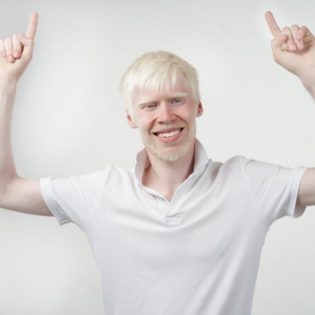 albino