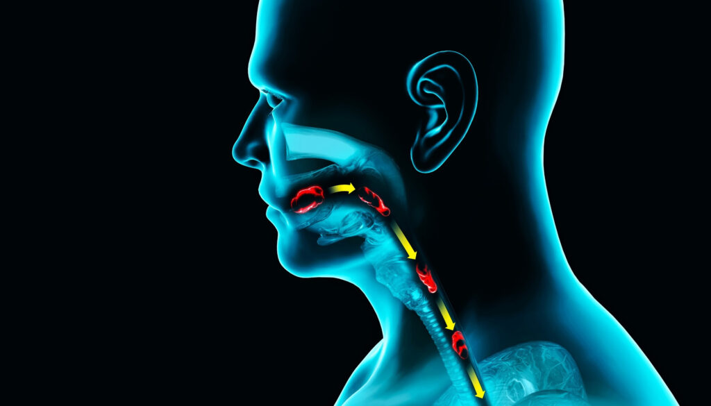 Dysphagia: Simptom, Punca, Komplikasi, Diagnosis & Rawatan 2 Dysphagia: Simptom, Punca, Komplikasi, Diagnosis & Rawatan 2