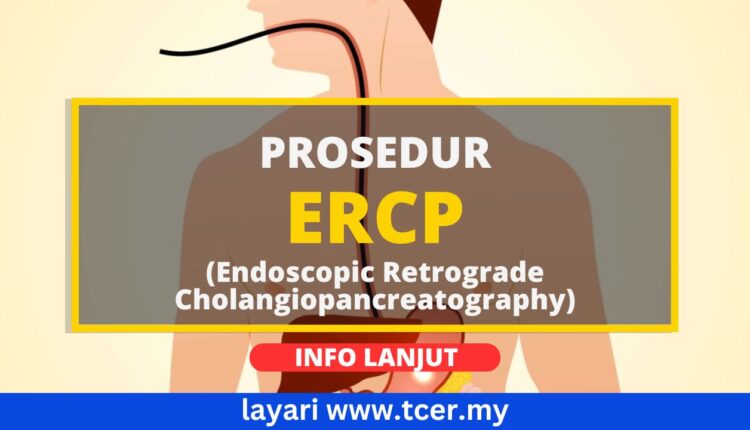 ERCP